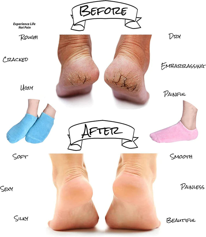 Crack Heal Silicon Spa Gel Socks For Men & Women